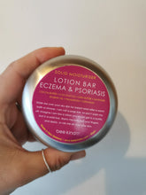 Load image into Gallery viewer, Bee Kind & Co - Eczema & Psoriasis soothing relief lotion bar Eko Hub